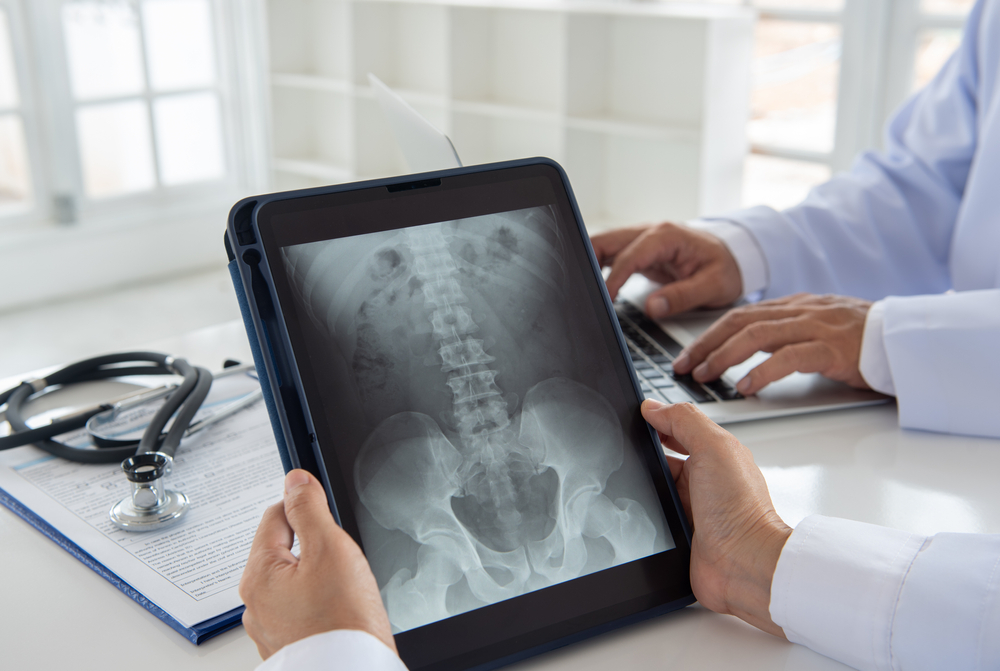 back xray of car accident aggravated pre-existing condition for settlement review